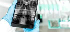 Oral x-rays on portable tablet